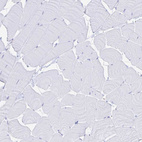 Immunohistochemical staining of human skeletal muscle shows no positivity in myocytes as expected.