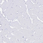 Immunohistochemical staining of human skeletal muscle shows no positivity in myocytes as expected.