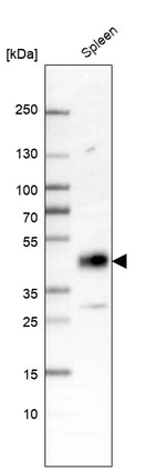 Western blot analysis in human spleen tissue.