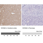 Anti-KCNQ2 Antibody