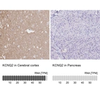Anti-KCNQ2 Antibody