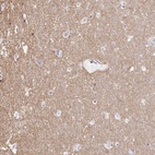 Immunohistochemical staining of human cerebral cortex shows high expression.