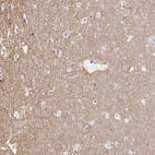 Immunohistochemical staining of human cerebral cortex shows high expression.