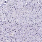 Immunohistochemical staining of human pancreas shows low expression as expected.