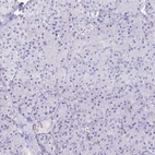 Immunohistochemical staining of human pancreas shows low expression as expected.