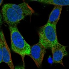 Immunofluorescent staining of human cell line SH-SY5Y shows localization to endoplasmic reticulum.