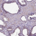 Immunohistochemical staining of human prostate shows moderate membranous positivity in glandular cells.