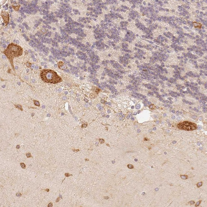 Anti-FAM189A2 Antibody