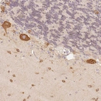 Anti-FAM189A2 Antibody