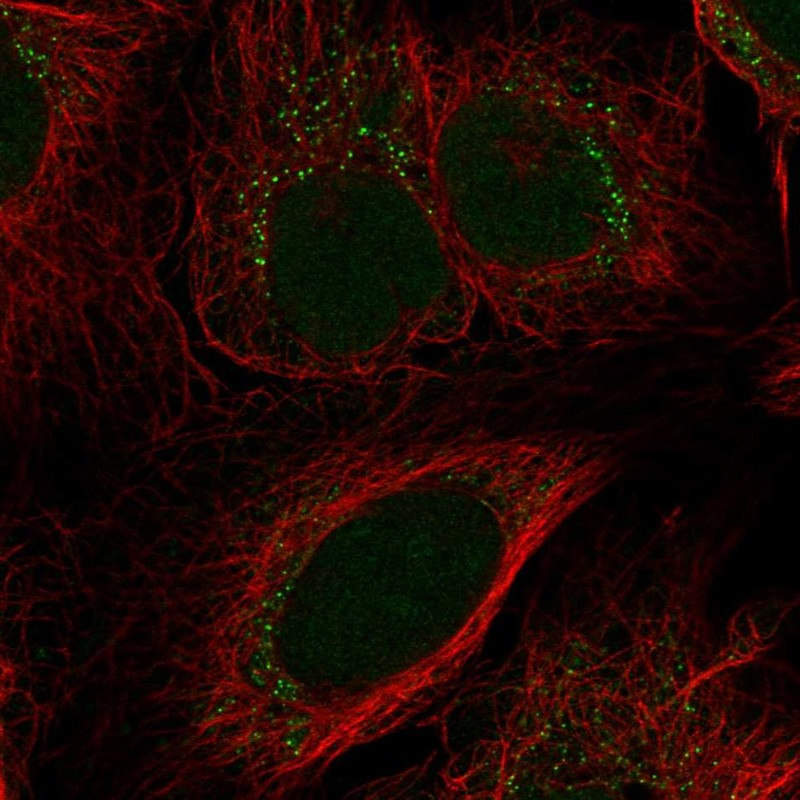 Anti-TIGD6 Antibody