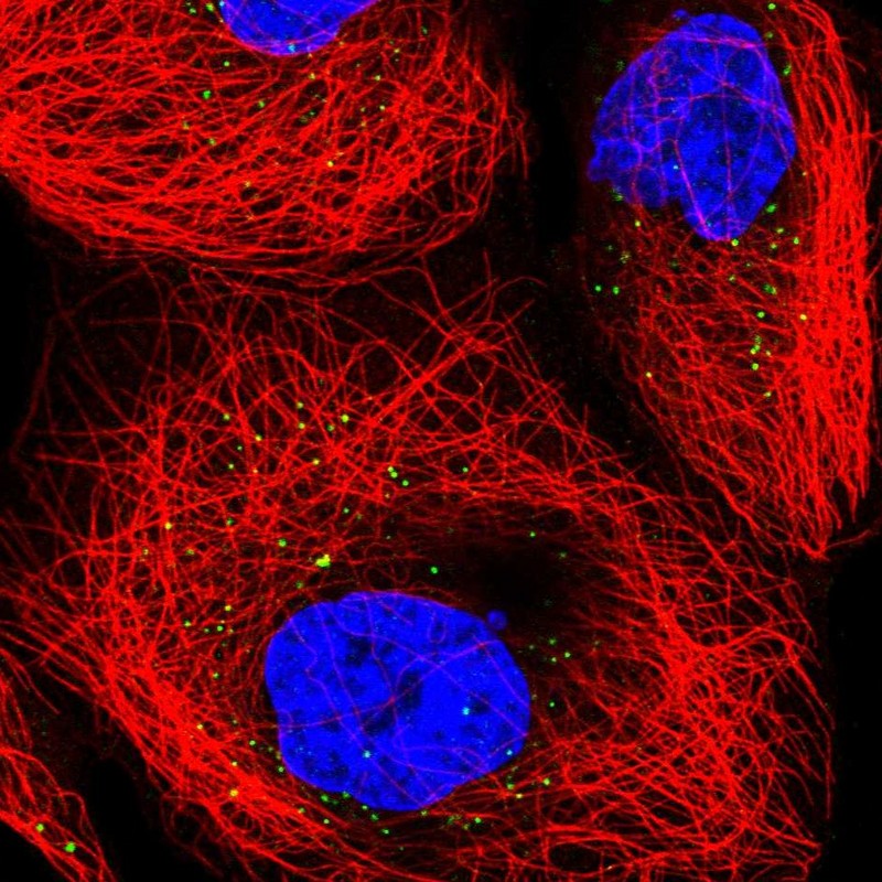 Anti-TRUB1 Antibody