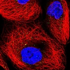 Anti-TRUB1 Antibody
