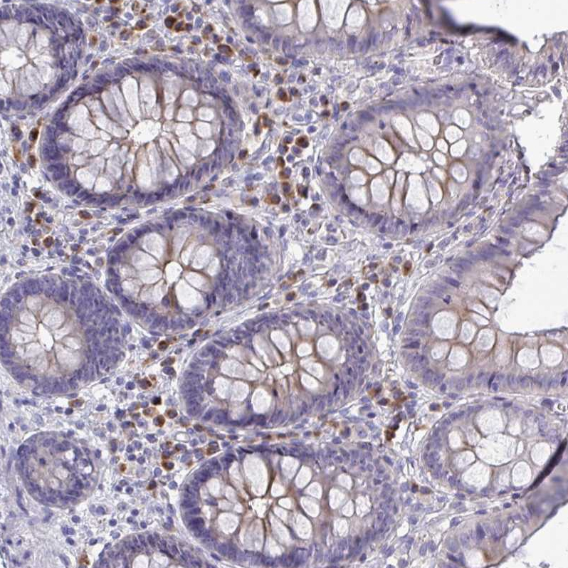 Anti-LRRC58 Antibody
