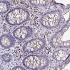 Anti-LRRC58 Antibody