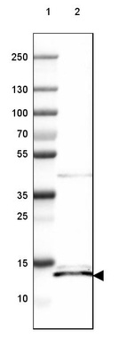 Lane 1: Marker [kDa] 250, 130, 100, 70, 55, 35, 25, 15, 10_br/_Lane 2: Human Liver tissue
