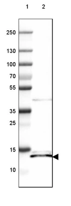 Lane 1: Marker [kDa] 250, 130, 100, 70, 55, 35, 25, 15, 10_br/_Lane 2: Human Liver tissue