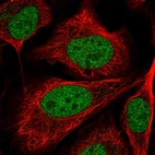 Immunofluorescent staining of human cell line U-2 OS shows localization to nucleoplasm.