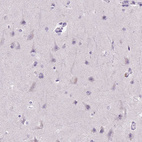 Immunohistochemical staining of human cerebral cortex shows no positivity in neuronal cells as expected.