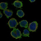 Anti-GABRG1 Antibody