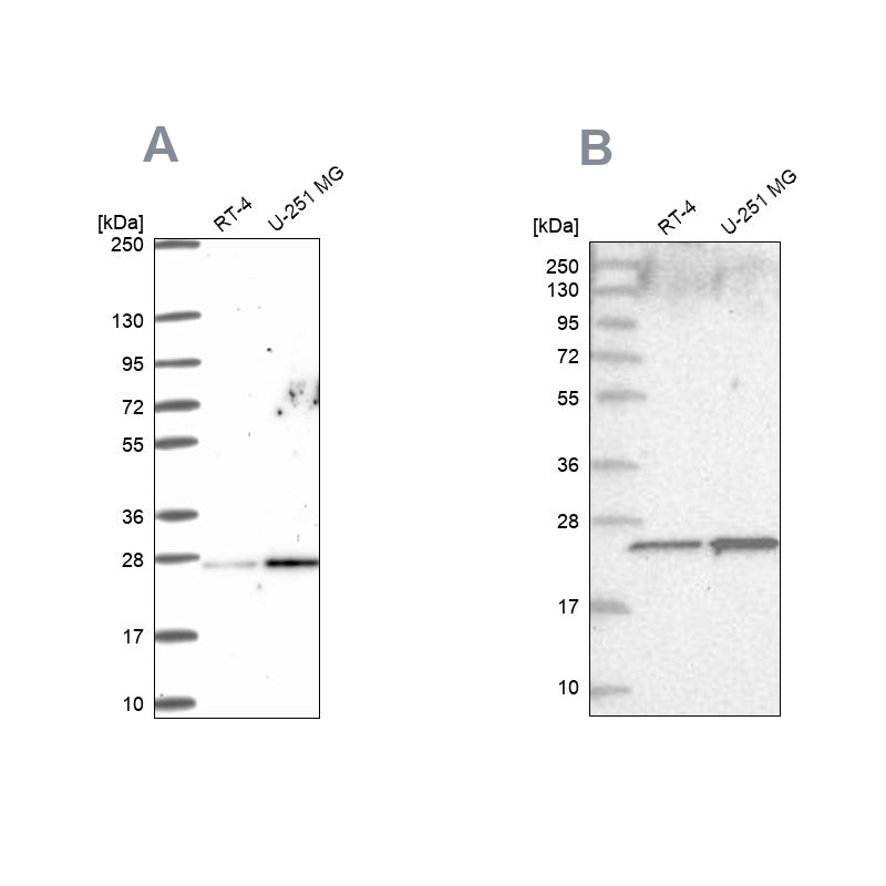 Anti-NOP16 Antibody