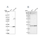 Anti-NOP16 Antibody