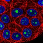 Immunofluorescent staining of human cell line MCF7 shows localization to nucleoli.