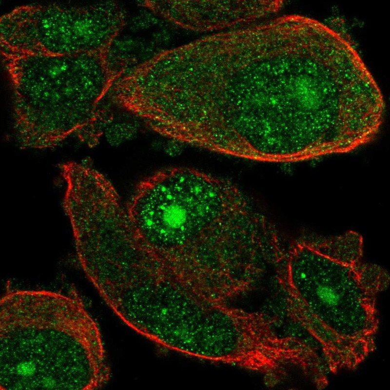Anti-WDSUB1 Antibody