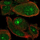 Anti-WDSUB1 Antibody