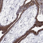 Anti-MMAA Antibody