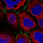 Anti-PLEKHG6 Antibody