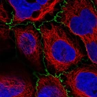 Anti-PLEKHG6 Antibody