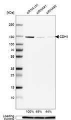 Western blot analysis in MCF-7 cells transfected with control siRNA, target specific siRNA probe #1 and #2, using Anti-CDH1 antibody. Remaining relative intensity is presented. Loading control: Anti-GAPDH.