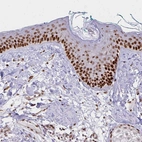 Immunohistochemical staining of human skin shows nuclear positivity in epidermal cells.