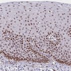 Immunohistochemical staining of human esophagus shows nuclear positivity in squamous epithelial cells.