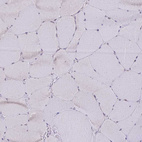 Immunohistochemical staining of human skeletal muscle shows no positivity in myocytes as expected.
