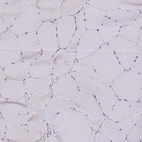 Immunohistochemical staining of human skeletal muscle shows no positivity in myocytes as expected.