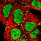 Immunofluorescent staining of human cell line HEK 293 shows localization to nucleoplasm & cell junctions.
