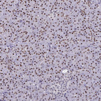 Anti-DDX39B Antibody