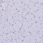 Immunohistochemical staining of human skeletal muscle shows strong nuclear positivity in myocytes.