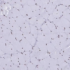 Immunohistochemical staining of human skeletal muscle shows strong nuclear positivity in myocytes.
