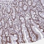 Immunohistochemical staining of human small intestine shows strong nuclear positivity in glandular cells.