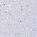 Immunohistochemical staining of human cerebral cortex shows no nuclear positivity in neuronal cells as expected.