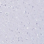 Immunohistochemical staining of human cerebral cortex shows no nuclear positivity in neuronal cells as expected.