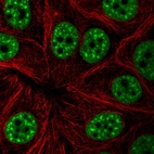 Immunofluorescent staining of human cell line MCF7 shows localization to nuclear speckles.