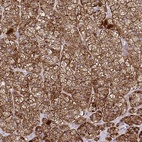 Anti-LIMS1 Antibody