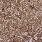 Anti-LIMS1 Antibody