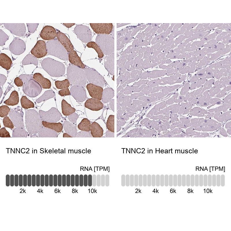 Anti-TNNC2 Antibody