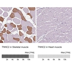 Anti-TNNC2 Antibody