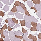 Immunohistochemical staining of human skeletal muscle shows high expression.