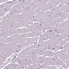 Immunohistochemical staining of human heart muscle shows low expression as expected.